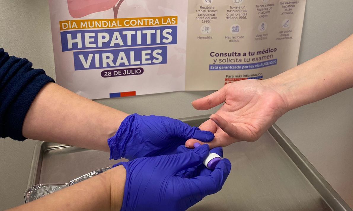 Hepatitis en Chile: Agrupación de hepatólogos refuerza tamizaje en embarazadas y población de riesgo