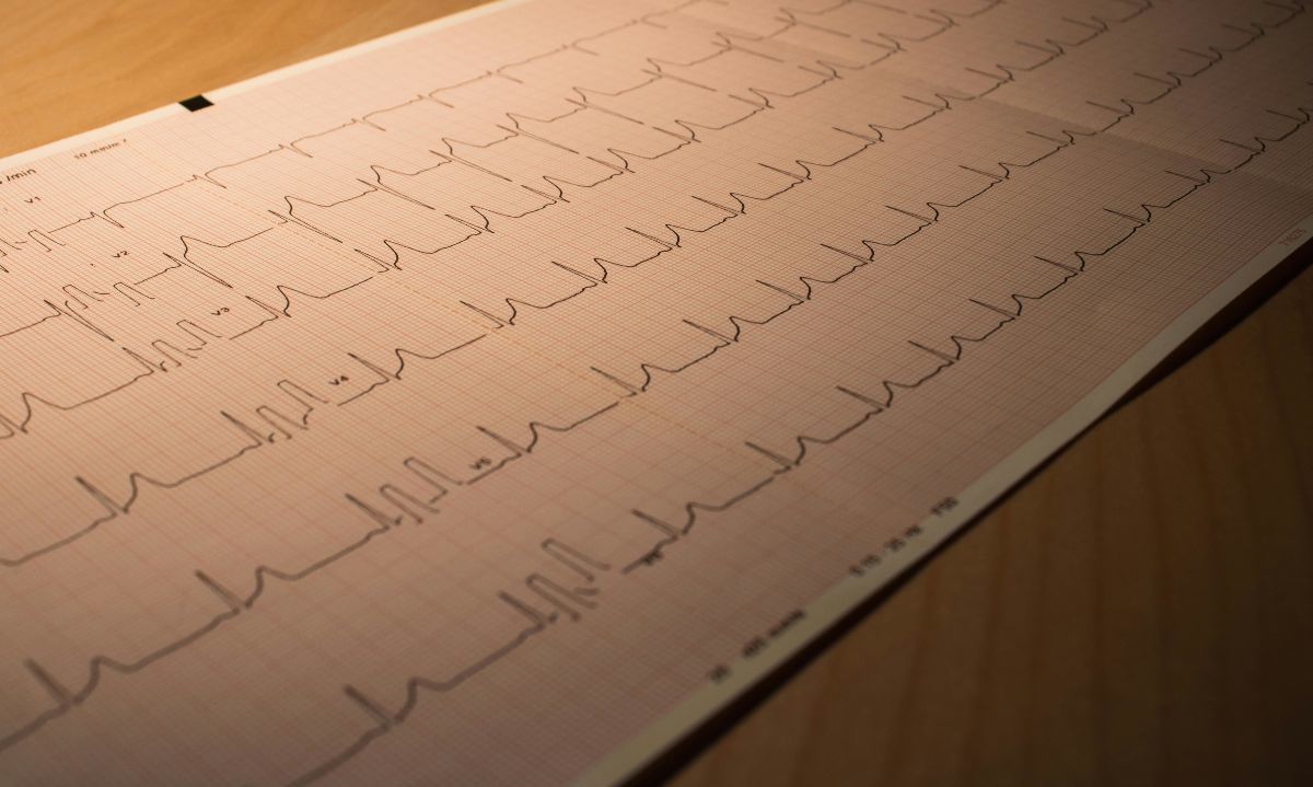 Cardiopatías congénitas: la principal causa de muerte en menores de un año